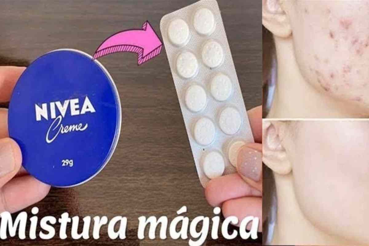 Fórmula Caseira Poderosa com Creme Nivea e Azeite Extra Virgem: Clareia Manchas e Suaviza Rugas Profundas com Ingredientes de Alta Performance