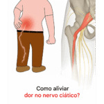 Dor no nervo ciático: 3 exercícios simples para aliviar o desconforto Imagem da página de origem