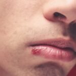 Se aparecer essa marca na boca, isto é o que seu corpo está tentando avisar Imagem da página de origem