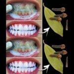 Você sabe como remover tártaro e clarear os dentes naturalmente? Imagem da página de origem