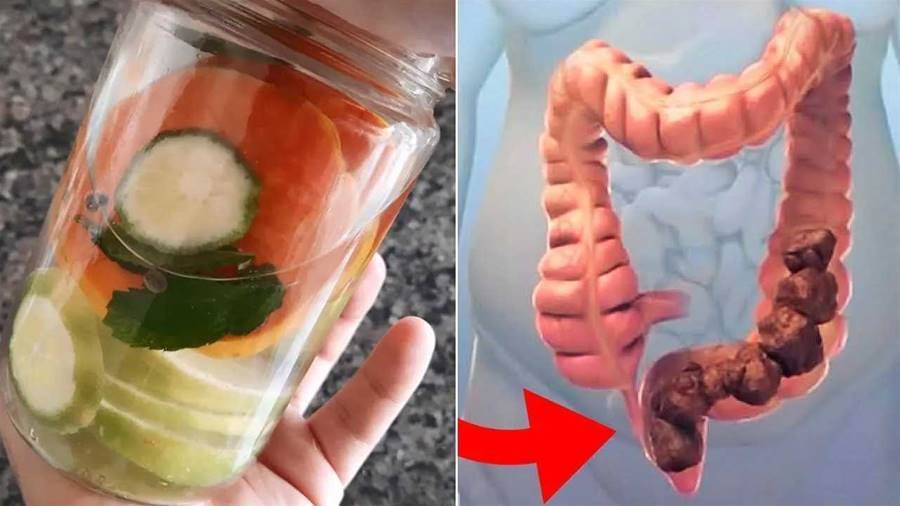 Tome Essa Mistura Antes de Dormir e Elimine 5 Quilos de Cocô Preso no Seu Intestino