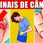 12 Sinais De Câncer Ignorados Principalmente Pelas Mulheres BFFE4FD95D08w900h506