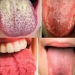 Se você estiver apresentando esses quatro sintomas na língua, eles podem indicar problemas de saúde | Receitas Salgadas 847