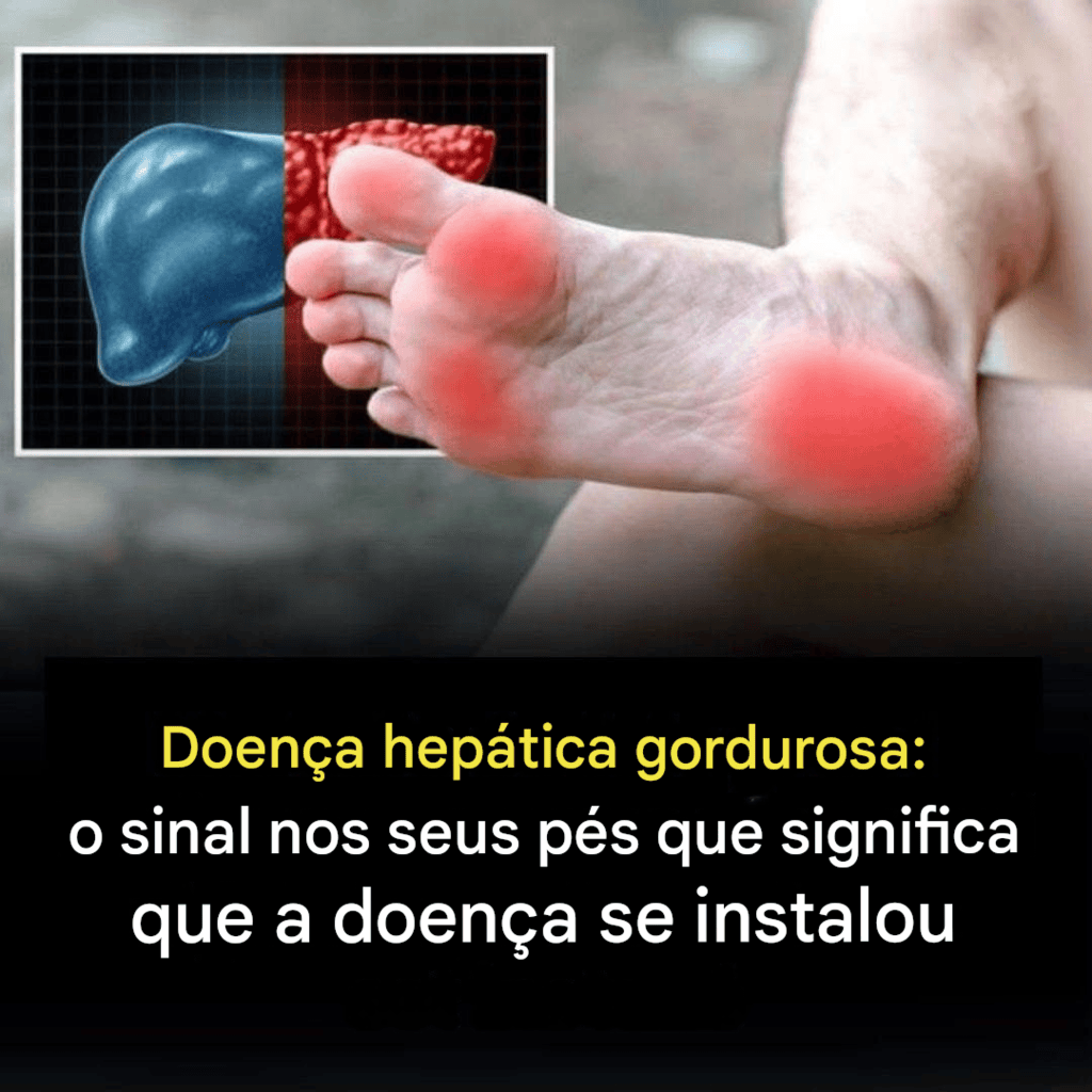 Doença Hepática Gordurosa: O Sinal Silencioso nos Pés que Pode Salvar Seu Fígado