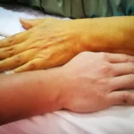 Fígado em Alerta: 6 Sinais na Pele que Podem Indicar Doença Hepática 37fb6bf9-80af-41a7-9cd7-660380b6ed6e