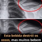 A Bebida Silenciosa: Desvendando o Impacto do Refrigerante na Saúde Óssea 6fac3480-0679-463d-adab-06fe4a7a8d92-1