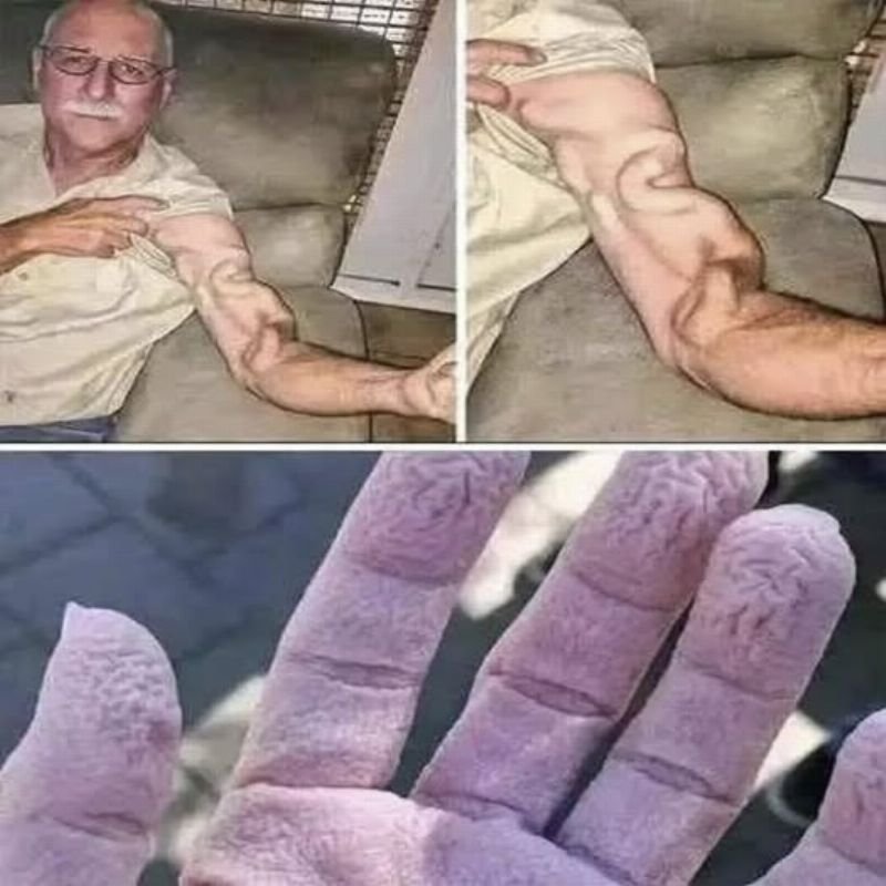 Dor no Braço ao Alongar? Descubra o Motivo e Soluções!