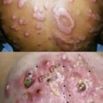 O Vilão Silencioso da Sua Pele: Como Hábitos Noturnos Podem Prejudicar Sua Beleza bb63d592-f848-4e44-9d02-77c930b817ee-1