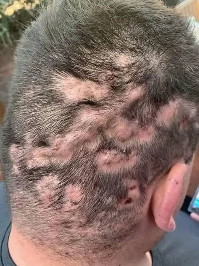 Sinais de Alerta Precoce: Ouça o Que Seu Corpo Diz!