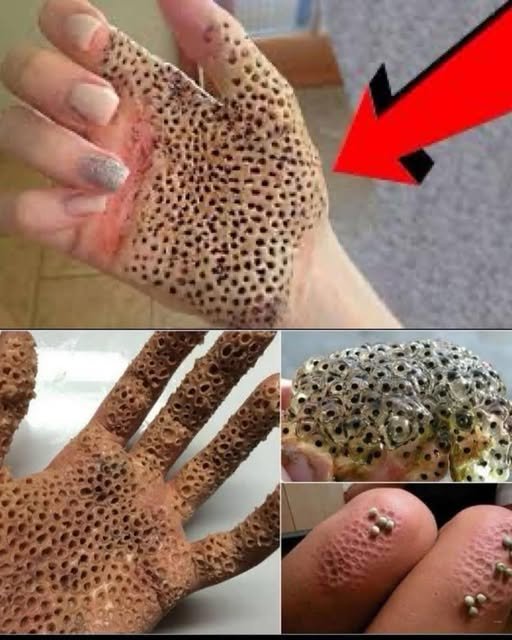 O Vilão Silencioso da Sua Pele: Por Que Dormir de Lado Pode Estar Acelerando o Envelhecimento - Guia Receita