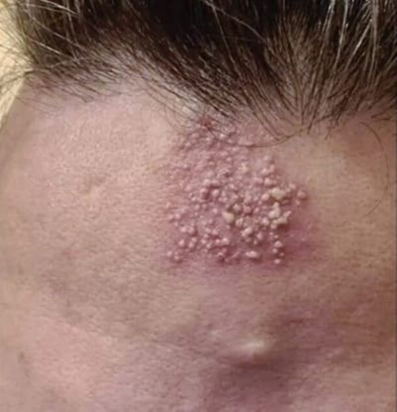 Revitalize Sua Pele: Diga Adeus ao Hábito Noturno!