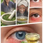 Goiaba para Olhos: O Cuidado Natural que Você Merece 41f22b52-196d-4130-a816-f218548ed972