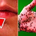 Sinais de Diabetes: 20 Alertas Ocultos para Reconhecer 112ae0de-1141-4a2e-806c-63352bce15d8-1