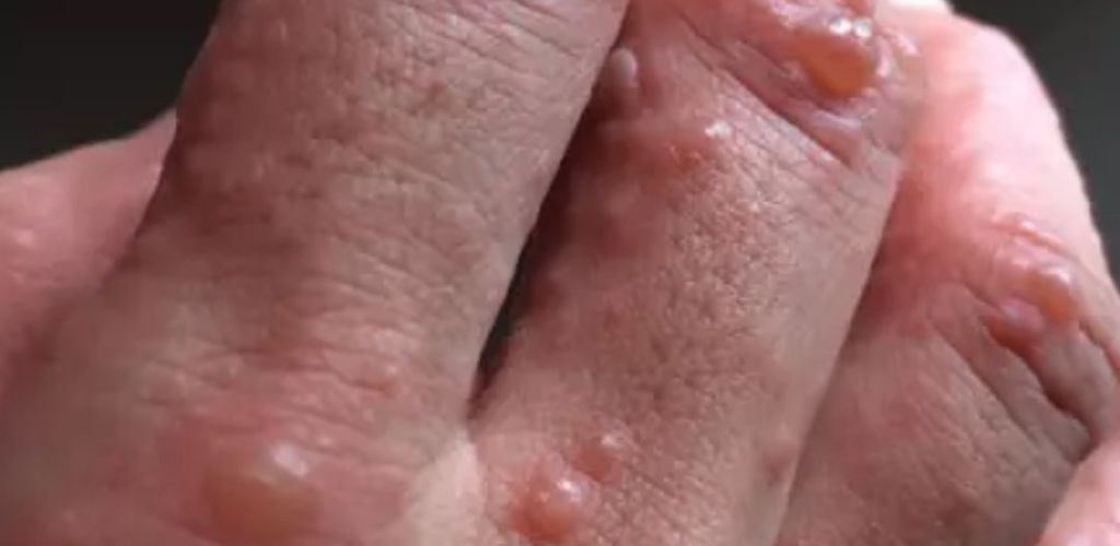 Pontos Vermelhos na Pele: Causas e Sinais de Alerta