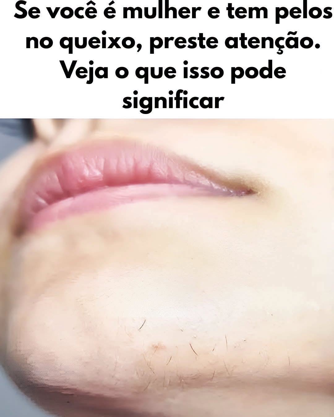 Pelos no Queixo em Mulheres: Entenda o Que Isso Significa!