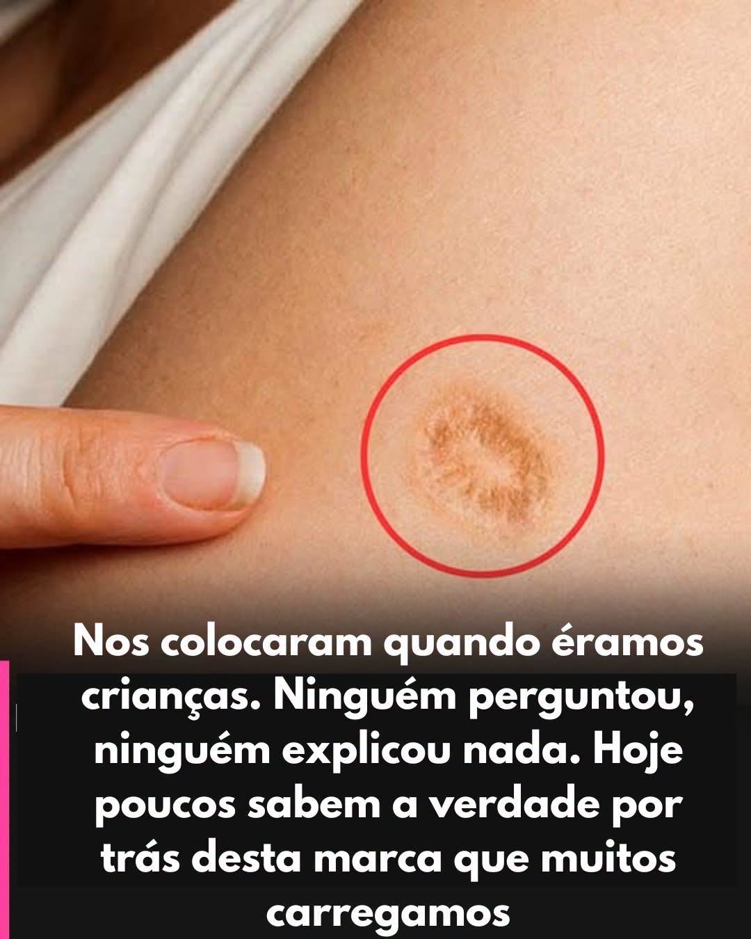 Descubra o Mistério por Trás da Sua Cicatriz Enigmática