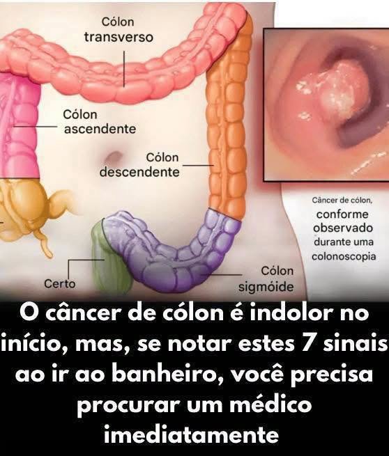 Sinais ao ir ao Banheiro: 7 Sinais de Alerta para Agir Agora!