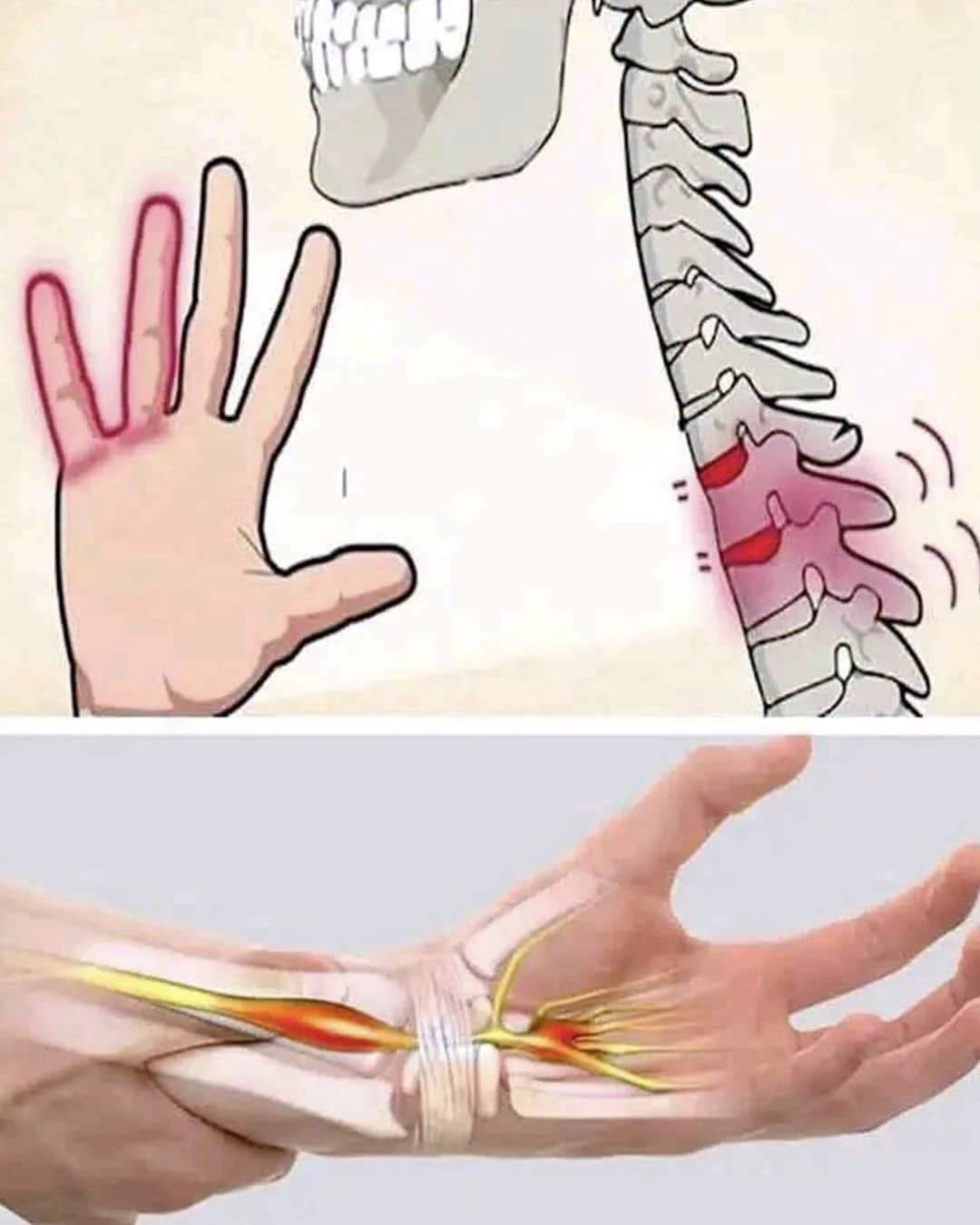 Mãos Adormecidas: O Que Elas Estão Tentando Te Dizer?