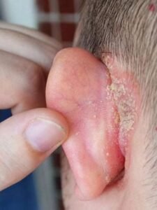 Mancha Estranha na Orelha do Filho: O Que Fazer Antes da Consulta Médica?