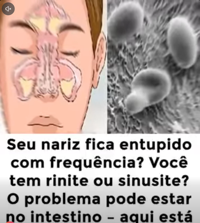 Nariz Entupido: Sua Solução Começa no Intestino